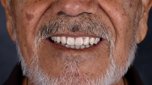 Female patient after dental work